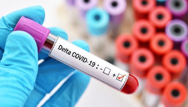 COVID-19, again global pandemic slowdown